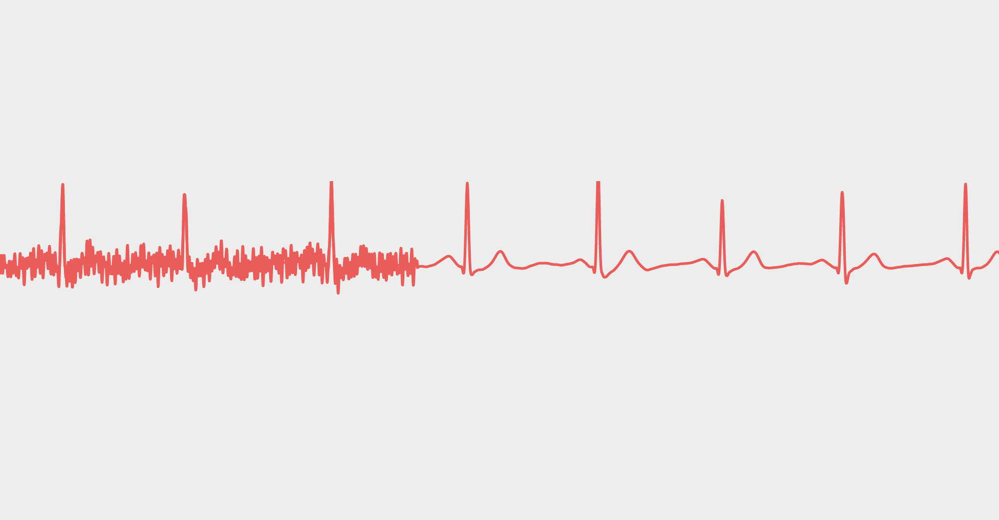 HeartKey 2.0: Enabling EKG Everywhere | B-Secur