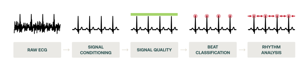 How HeartKey Rhythm processes noisy signals